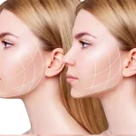 عکس جراحی بوکال فت