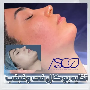 هزینه بوکال فت