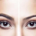 کلینیک کاشت ابرو در سعادت آباد