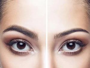 کلینیک کاشت ابرو در سعادت آباد