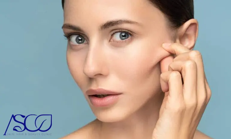 آسیب به غدد بزاقی از عوارض بوکال فت