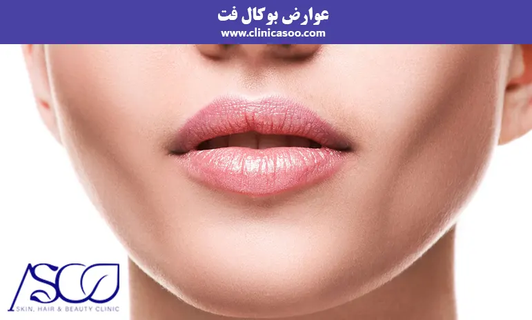 عوارض بوکال فت