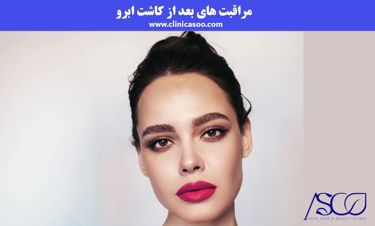مراقبت های بعد از کاشت ابرو