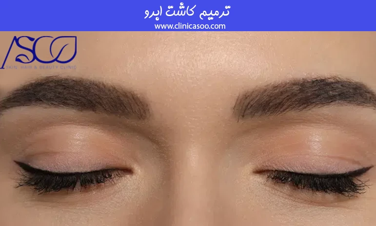 ترمیم کاشت ابرو