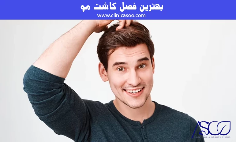 بهترین فصل کاشت مو