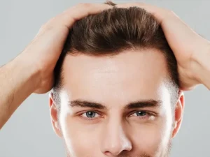 مقایسه فصول مختلف برای کاشت مو