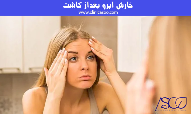 خارش ابرو بعد از کاشت