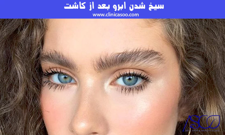 سیخ شدن ابرو بعد از کاشت