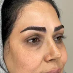 مراحل کاشت ابرو طبیعی