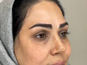 مراحل کاشت ابرو طبیعی