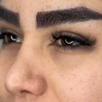 بهترین کلینیک کاشت ابرو
