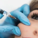 عکس تزریق فیلر