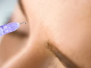 مزایای بوتاکس