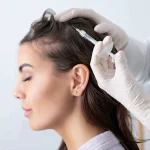 مزایای کاشت مو با سلول های بنیادی