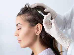 مزایای کاشت مو با سلول های بنیادی