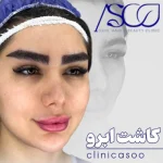کلینیک آسو بهترین کلینیک کاشت ابرو