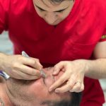 بلفاروپلاستی در کلینیک آسو