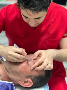 بلفاروپلاستی در کلینیک آسو