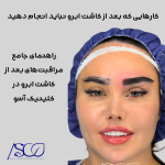 کارهایی که بعد از کاشت ابرو نباید انجام دهید، راهنمای جامع مراقبت‌های بعد از کاشت ابرو در کلینیک آسو