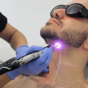 لیزر موهای زائد، حکم شرعی لیزر موهای زائد، آیا لیزر موهای زائد حرام است، حکم لیزر در اسلام، لیزر بیکینی از نظر شرعی، نظر مراجع درباره لیزر