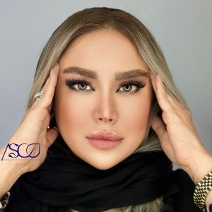 بلفارو گربه‌ای